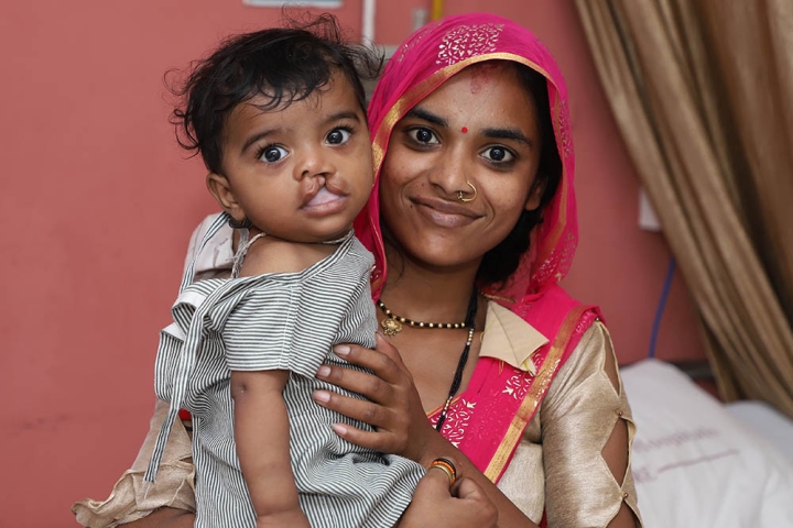 Boy readies for cleft lip surgery with his mom