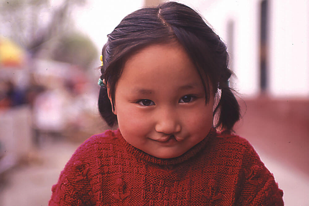 2007: Smile Train celebrates our 200,000th sponsored cleft surgery!