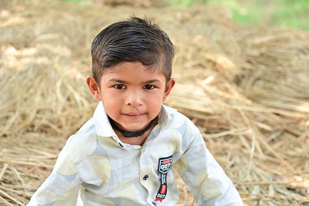 Jairaj smiling after cleft surgery