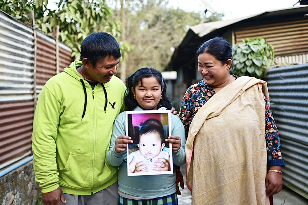 Bena smiling with her parents and holding a picture of herself before cleft surgery