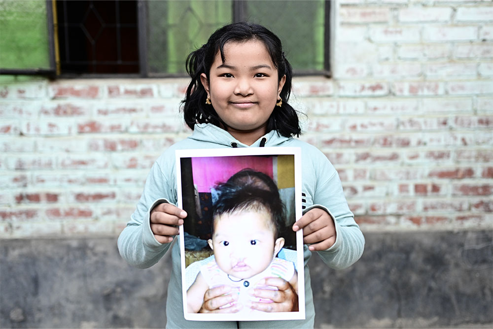 Bena smiling and holding a picture of herself before cleft surgery