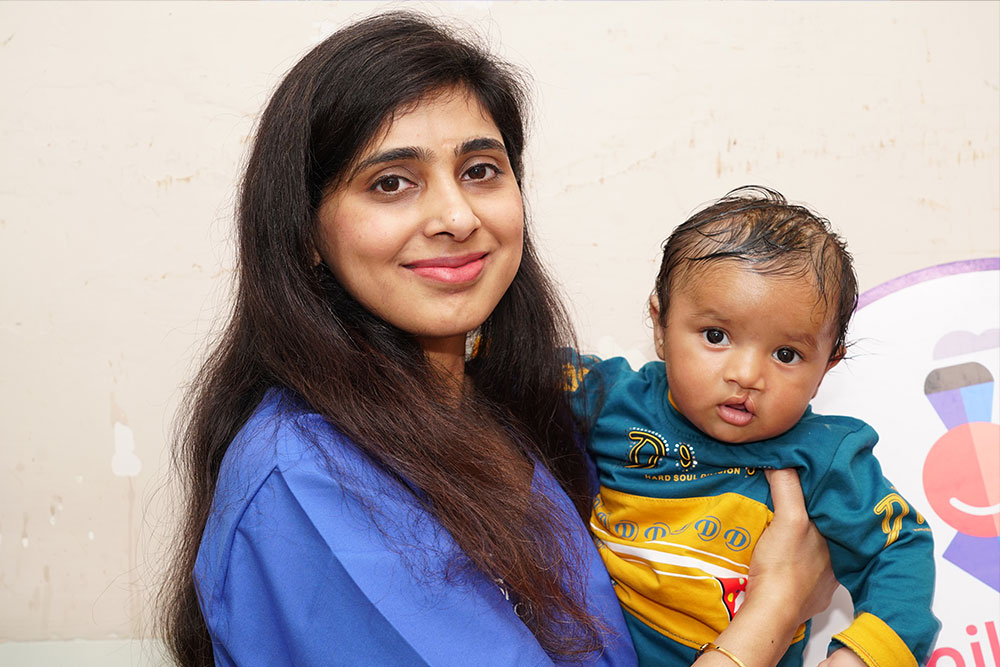 Payal hold a baby with a cleft