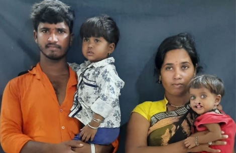 Aarohi before cleft surgery with her mother Sonali and father Arjun