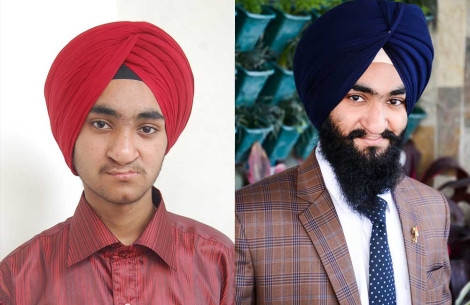 Harkirat Singh Paras after cleft surgery