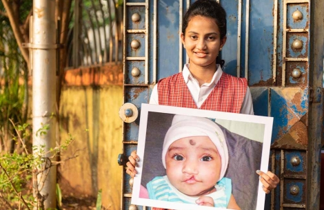 Bhargavi holding a picture of herself before cleft surgery