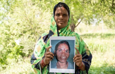 Surekha smiling and holding a picture of herself before cleft surgery