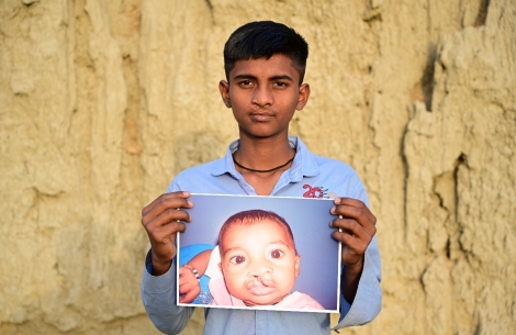 Monu smiling and holding a photo of himself from before cleft surgery