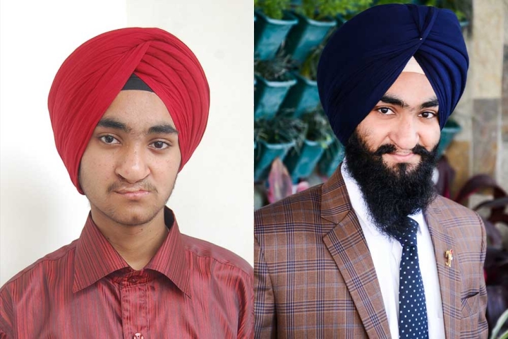 Harkirat Singh Paras after cleft surgery