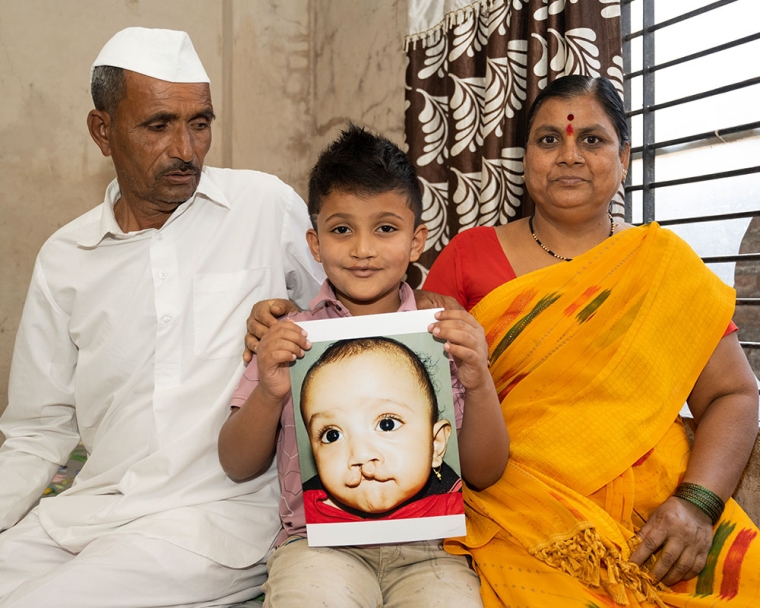 Abhay smiling with his parents and holding a picture of himself before cleft surgery